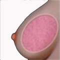 Gel Brüste