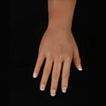 Gehärtete Hand–1