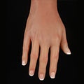 Normal-Hand–1